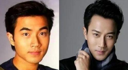 欧美脸型整形图片男士,欧美男士脸型整形案例解析